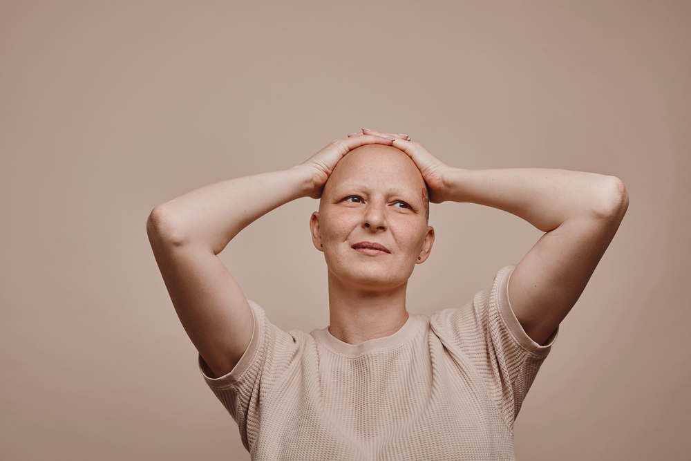Alopecia universalis